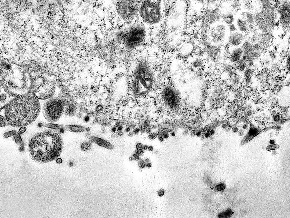 Vírus já disseminado pelas células por Foto:Divulgação/Fiocruz