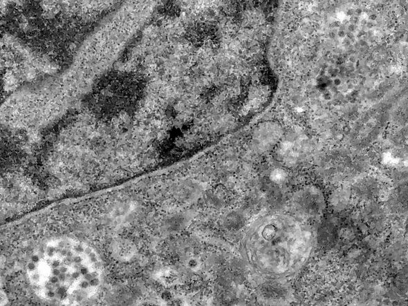 Vírus tenta romper membrana celular por Foto:Divulgação/Fiocruz