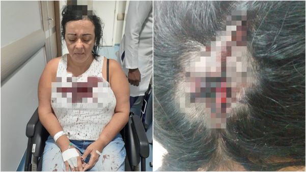 Professora é agredida com coronhadas na cabeça