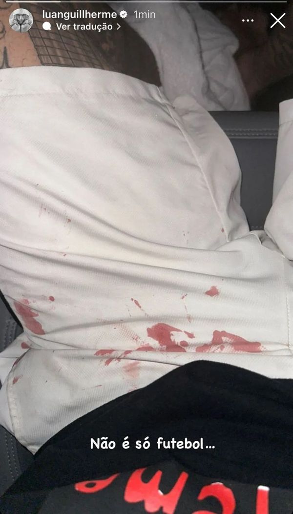 Luan, do Corinthians, postou foto de bermuda com sangue