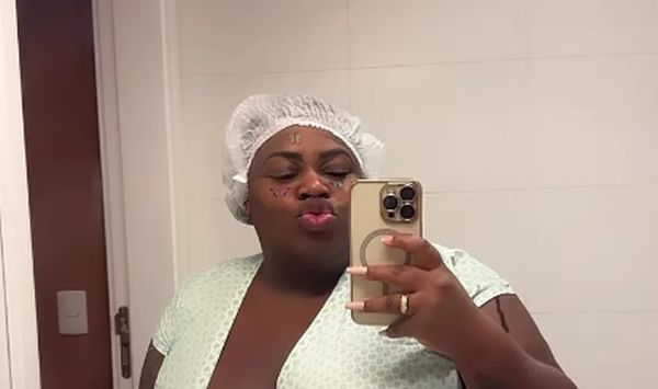 Jojo Todynho passou por bariátrica