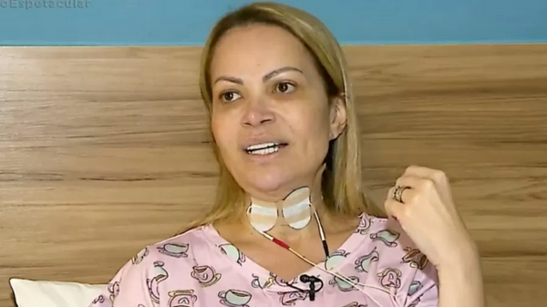 Solange Almeida revela lesão nas cordas vocais