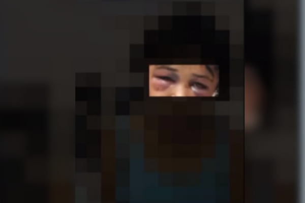 A vítima da tentativa de feminicídio foi socorrida para o HGE, onde recebe atendimento por Reprodução/ TV Bahia