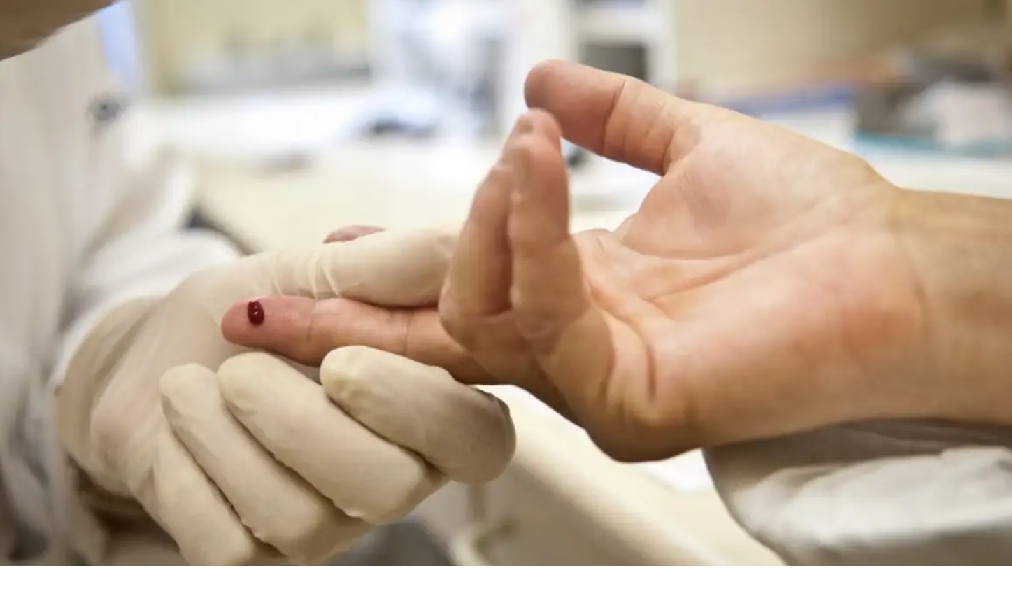 Exame para HIV por Arquivo Agência Brasil