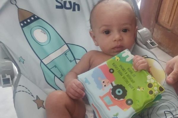 Família de bebê com assimetria no crânio faz vaquinha para pagar capacete