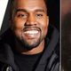 Imagem - Kanye West coloca prótese de titânio de R$ 4 milhões nos dentes