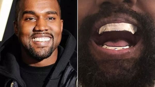 Kanye West e nova prótese dentária