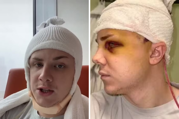 Brandon precisou ter o crânio removido para lavagem do cérebro após contrair infecção