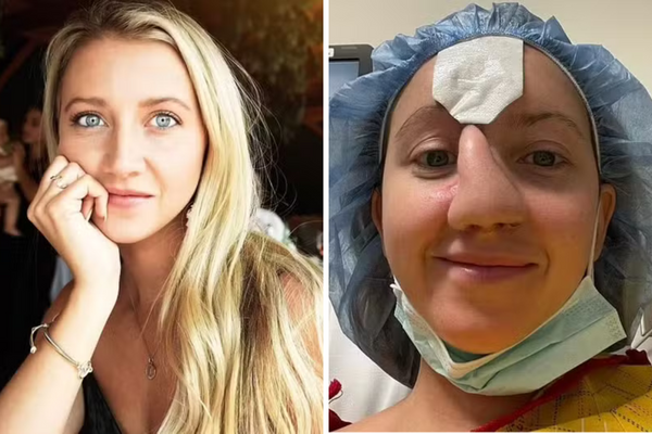 Antes e depois de americana atacada por cachorro