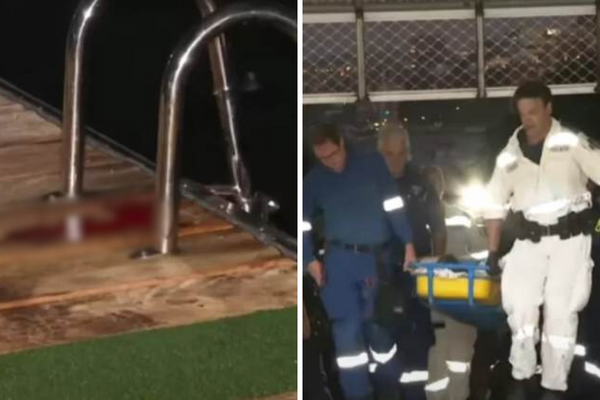 Uma mulher de 25 anos ficou gravemente ferida após ser mordida por um tubarão na Austrália