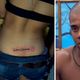 Imagem - Mulher tatua 'Calma Calabreso' nas costas e viraliza: 'Aproveitei a onda do BBB'
