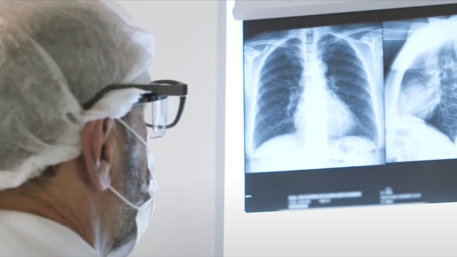 Imagem - Gripezinha, síndrome respiratória ou pneumonia? Entenda a diferença