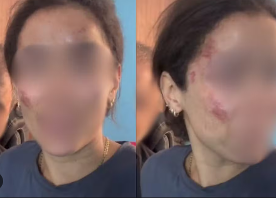 Brasileira pediu que não haja preconceito contra o país