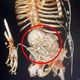 Imagem - Mulher descobre feto mumificado na barriga: 'Grávida há 56 anos'