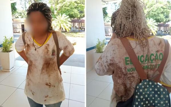 Menina de 12 anos sofreu ataque em escola