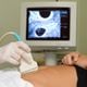 Imagem - STF analisa pedidos liminares para derrubar norma do CFM que proíbe procedimento pré-aborto