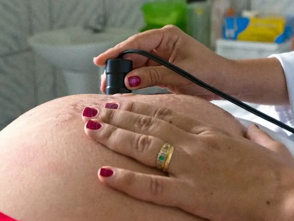 Imagem - Teste para HTLV passa a ser indicado para gestantes durante pré-natal