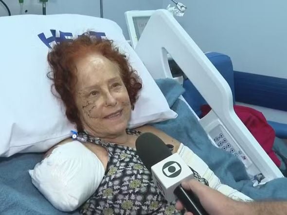 Imagem - Roseana Murray tem alta do hospital após perder braço e parte de uma das orelhas