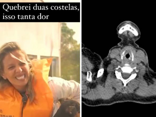 Imagem - Luisa Mell revela ter quebrado duas costelas durante resgates no RS