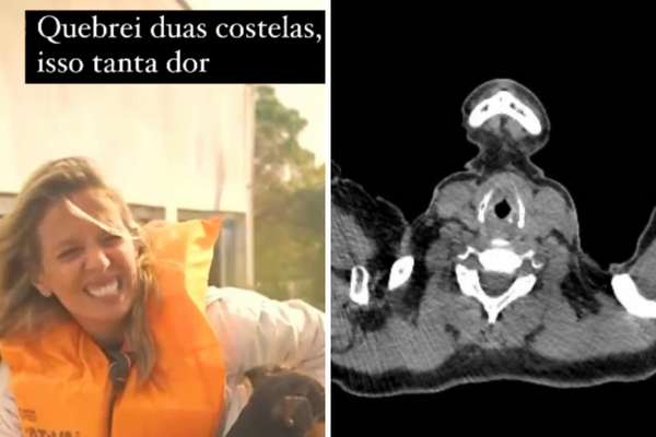 A ativista Luisa Mell revelou que quebrou duas costelas durante resgate de animais no Rio Grande do Sul