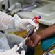 Imagem - Estudo aponta que doar sangue pode beneficiar a saúde do doador; veja como