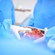 Imagem - Transplante de fígado aumenta sobrevida em
 pacientes com câncer de intestino em metástase