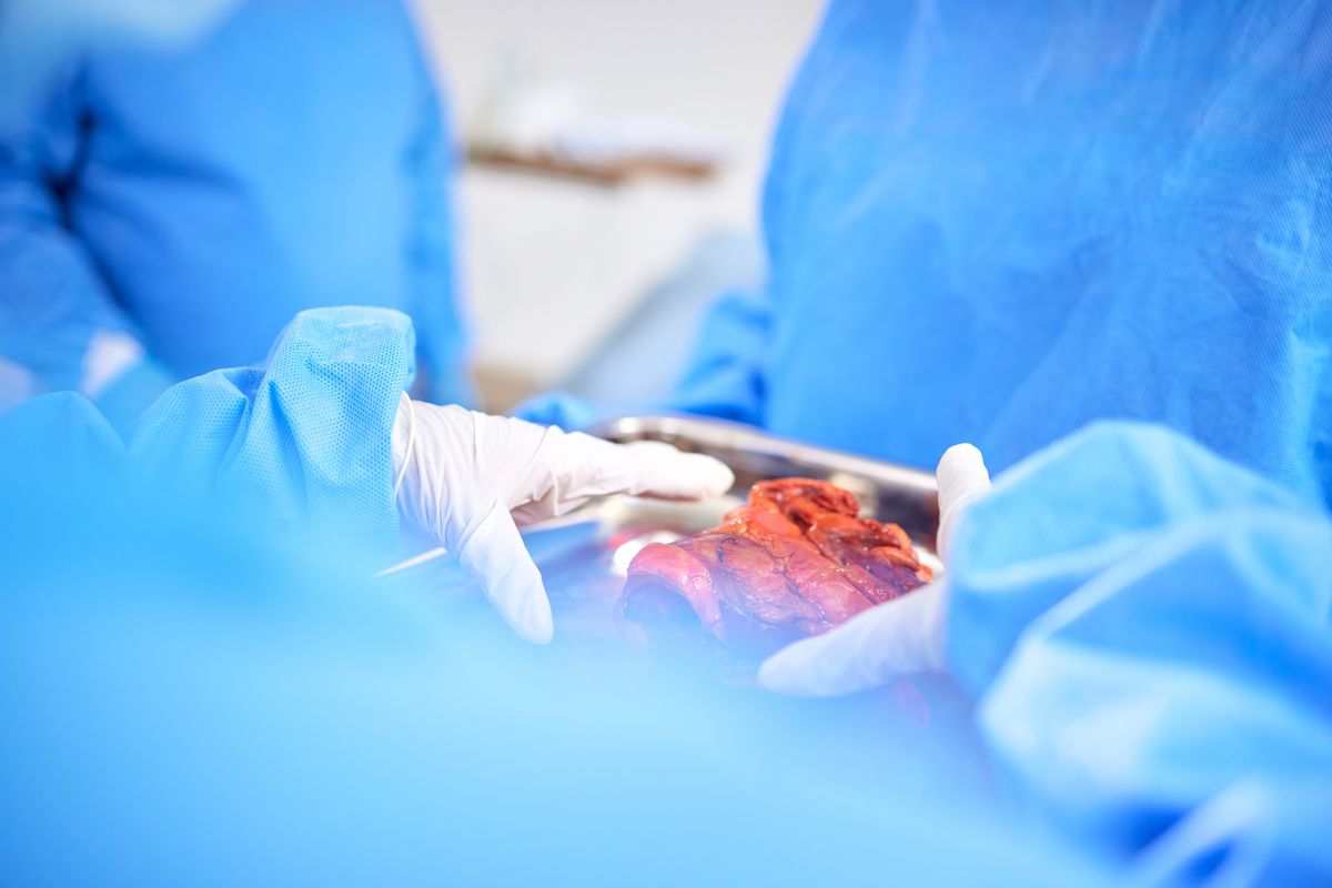 Transplante de fígado