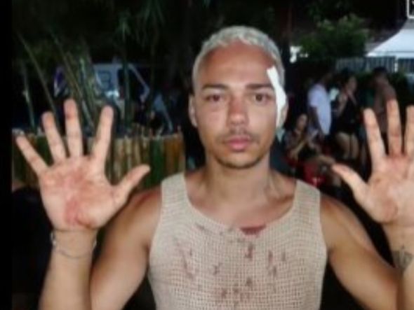 Imagem - Jovem denuncia agressão durante o São João em festa em Ibicuí