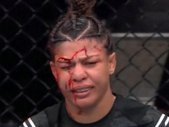 Imagem - Brasileira Mayra Sheetara sofre corte grotesco e perde luta no UFC 303