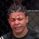 Imagem - Brasileira Mayra Sheetara sofre corte grotesco e perde luta no UFC 303