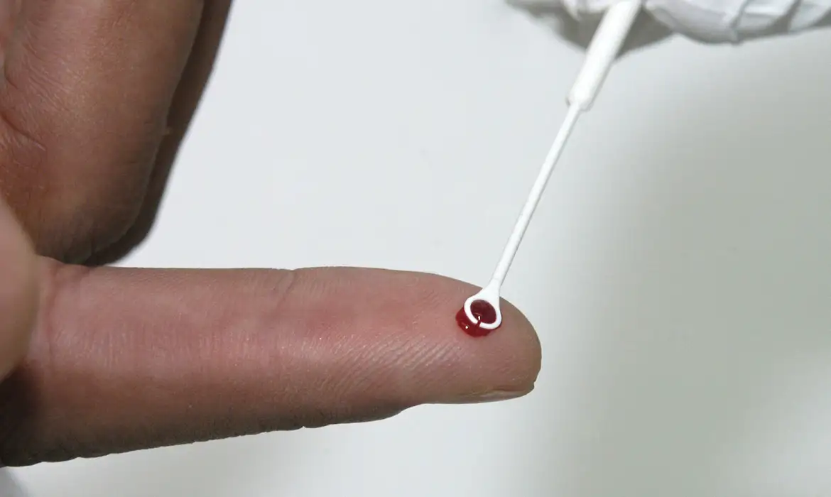 Teste de HIV por Vinicus Marinho/Fiocruz
