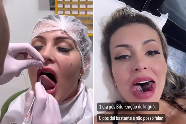 Andressa Urach choca a web ao aparecer com língua partida ao meio