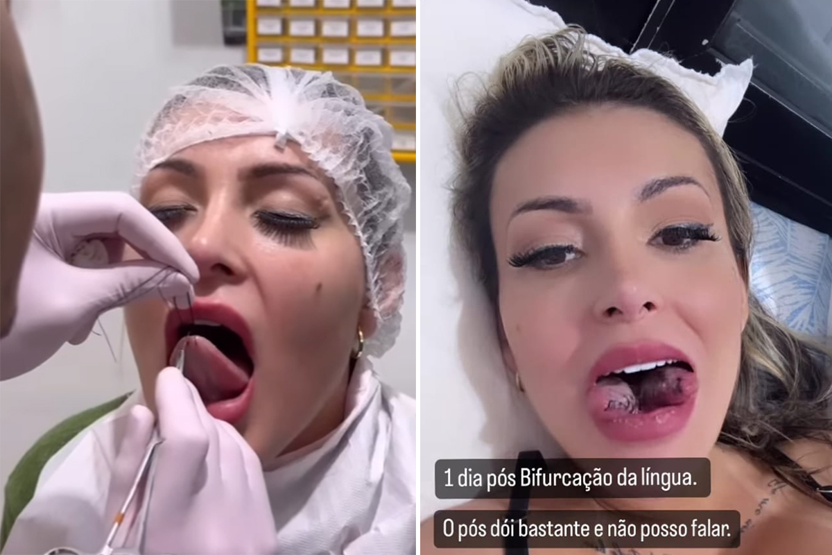 Andressa Urach choca a web ao aparecer com língua partida ao meio por Reprodução