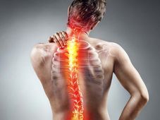 Imagem - Faculdade oferece atendimento gratuito de fisioterapia para escoliose em Salvador