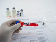 Imagem - Mpox volta a preocupar e Ministério da Saúde coloca oito estados em alerta máximo