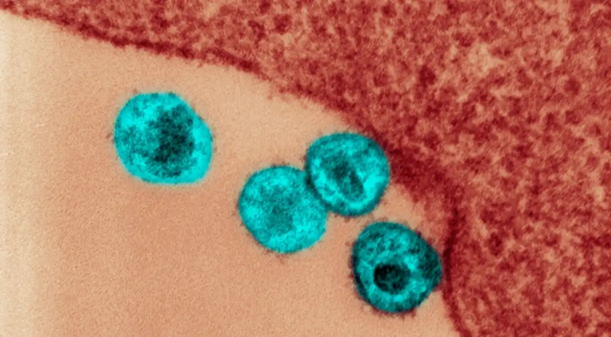 Nova variante do HIV por Divulgação