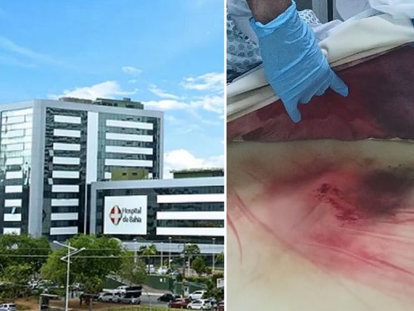 Imagem - Leito com sangue: paciente do Hospital da Bahia corre algum risco? Médica explica