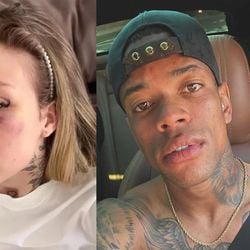 Imagem - Ex-esposa de atleta do Palmeiras denuncia abusos e mostra hematomas nas redes sociais