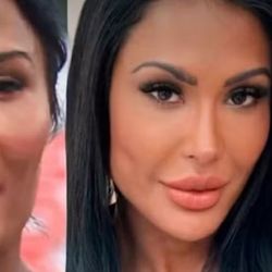 Imagem - Gracyanne Barbosa refaz harmonização facial e surpreende ao mostrar novo visual: 'Mais natural'