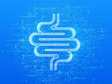 Imagem - SUS adota novo exame para detectar câncer de intestino antes de sintomas