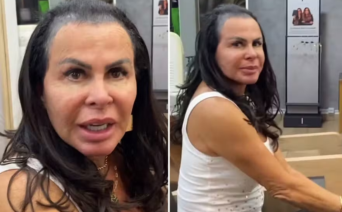 Gretchen expôs situação do cabelo por Reprodução