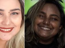 Imagem - Tumor e síndrome raros fazem jovem brasileira mudar de cor; entenda