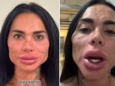 Imagem - Kamila Simioni surpreende ao mostrar nova harmonização facial: 'A boca dos sonhos'