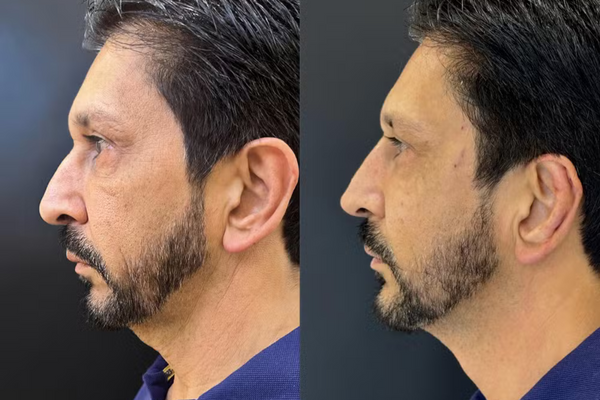 Antes e depois de Ricardo Nunes