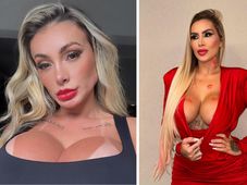 Imagem - Andressa Urach leva pontos no rosto após sair no tapa com Juju Ferrari: ‘O que é dela está guardado’