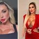 Imagem - Andressa Urach leva pontos no rosto após sair no tapa com Juju Ferrari: ‘O que é dela está guardado’