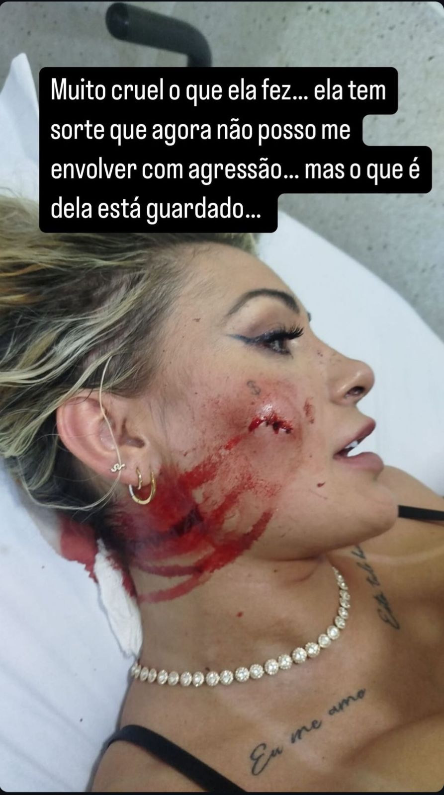 Andressa Urach dá respota à agressão de Ferrari por Reprodução / Redes Sociais
