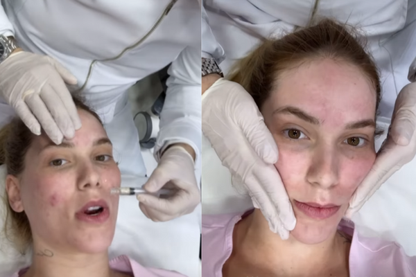 Virginia Fonseca faz tratamento facial