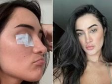 Imagem - Após paralisia facial por estresse, Gabi Melim realiza fisioterapia 3 vezes ao dia