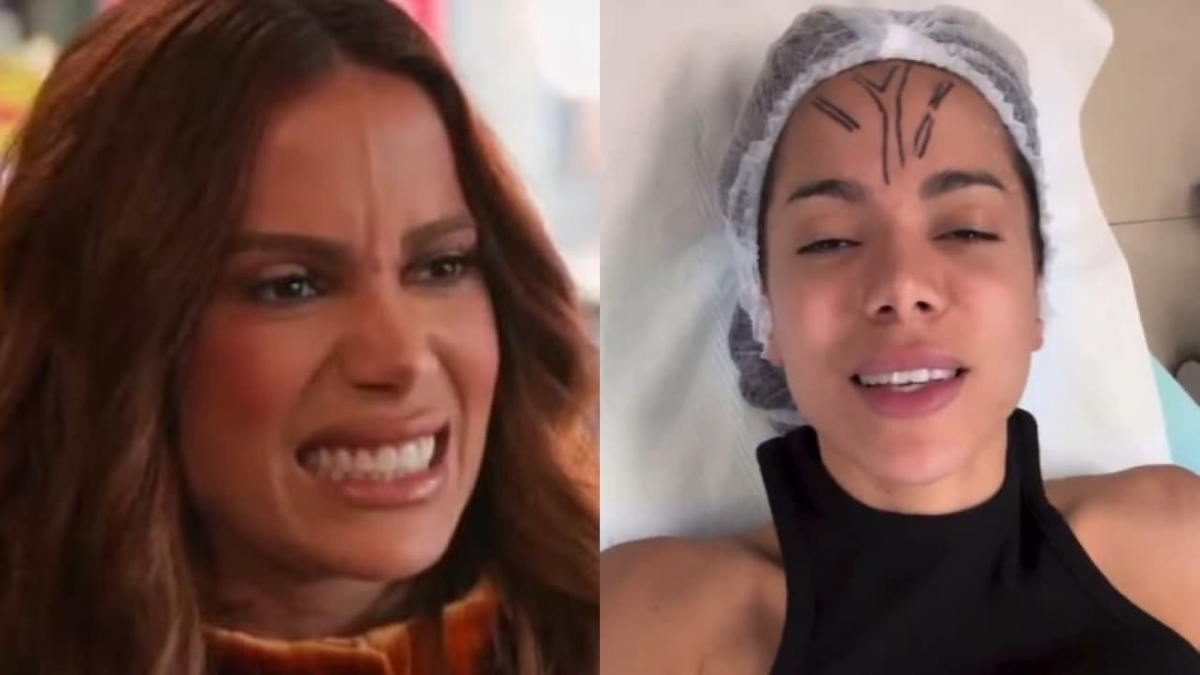 Anitta postou um vídeo anestesiada